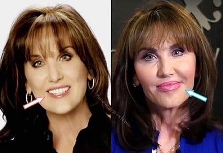 Robin McGraw before (left) and after (right).